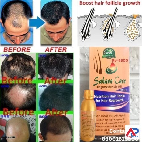 sahara-care-regrowth-hair-oil-in-gujranwala-03001819306-big-0